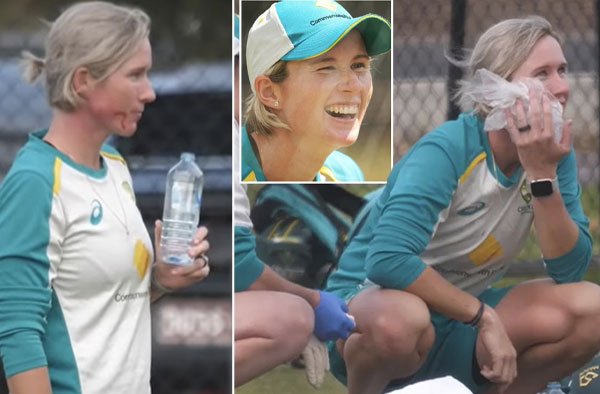 Australian opener Beth Mooney was left with a broken jaw after being struck by a ball in the nets ahead of the Women's Ashes series against England . PC: Cricket Australia / YouTube